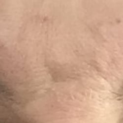 Master Brows - After