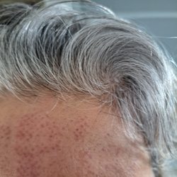 Skin Tight MedSpa Acton