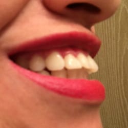 Westview Dental Center and Fastbraces - Fastbraces at this place do NOT work. The assistants did 99% of the work.