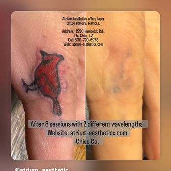 Atrium Aesthetics - Skin Care Near Me - Chico, California Atrium Aesthetics - Skin Care Near Me - Chico, California