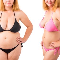 Amaryllis Pascual, MD - #AmaryllisPascualmd #AmaryllisPascualmdDoral #AmaryllisPascualMiami Miami Amaryllis Pascual MD https://jolieplasticsurgery.com/weight-loss-m