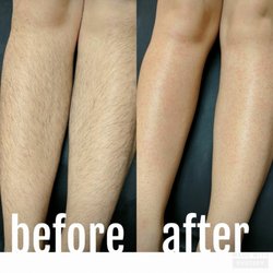 Sugaring Lv 13 Photos 26 Avis Sugar Waxing 5643 Centennial