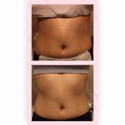 Aphrodite Curves - ‼BEFORE AND AFTER ONE SESSION ‼