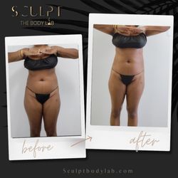 Sculpt The Body Lab - Non Invasive body sculpting