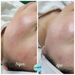 Skin By Gabby