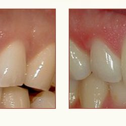 Holyoke Mall Dental