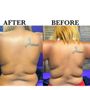 Photo of Lastyles Tighten Beauty Bar