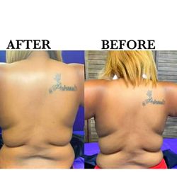 Lastyles Tighten Beauty Bar