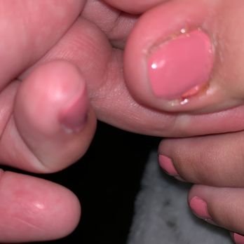 TA Nails & Spa - As you can see the blood and puss and left my toe infected from stabbing me due to rushing - Nail Salons Near Me - Norwalk, California TA Nails & Spa - As you can see the blood and puss and left my toe infected from stabbing me due to rushing - Nail Salons Near Me - Norwalk, California