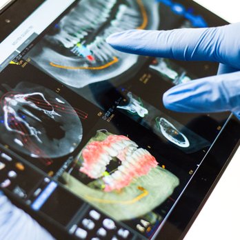 Prabhdeep K Gill DDS - Digital radiographs to minimize x-ray exposure - General Dentistry Near Me - Fresno, California Prabhdeep K Gill DDS - Digital radiographs to minimize x-ray exposure - General Dentistry Near Me - Fresno, California