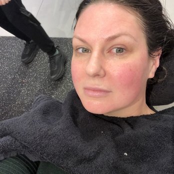 Facegym - Sculpted jawline after a clean + lift - Skin Care Near Me - New York, New York