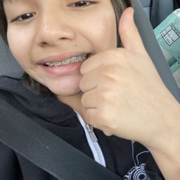 Braces and work done Braces and work done