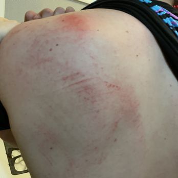 Papa Sam's Coney Island - my boyfriends back after the fight the person started - Burgers Near Me - Mount Morris, Michigan Papa Sam's Coney Island - my boyfriends back after the fight the person started - Burgers Near Me - Mount Morris, Michigan