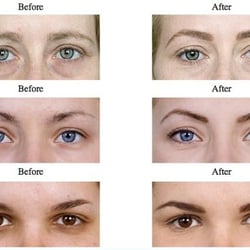 Perfect Eyebrows
