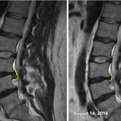 Solon Spine and Wellness Center