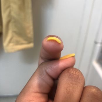 SB Nailbar - This is the "nail." Half of it is a tip as it cracked and the other half is half filled in with no shape. - Nail Salons Near Me - Santa Barbara, California SB Nailbar - This is the "nail." Half of it is a tip as it cracked and the other half is half filled in with no shape. - Nail Salons Near Me - Santa Barbara, California