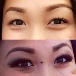 Center for Dermatology and Laser Surgery