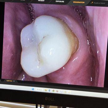 Del Mar Dental Studio - After - Cosmetic Dentists Near Me - Del Mar, California Del Mar Dental Studio - After - Cosmetic Dentists Near Me - Del Mar, California