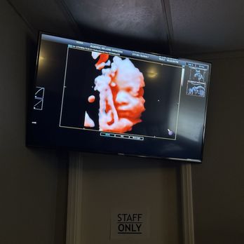 Heavenly 3D4D Ultrasound - Ultrasound - Diagnostic Imaging Near Me - Riverside, California Heavenly 3D4D Ultrasound - Ultrasound - Diagnostic Imaging Near Me - Riverside, California