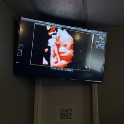 Heavenly 3D4D Ultrasound - Ultrasound