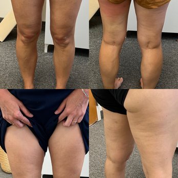 Chayban Wellness - Believe is before, above is after. Skin tightening, fast removal, collagen production - Health Coach Near Me - Solana Beach, California Chayban Wellness - Believe is before, above is after. Skin tightening, fast removal, collagen production - Health Coach Near Me - Solana Beach, California