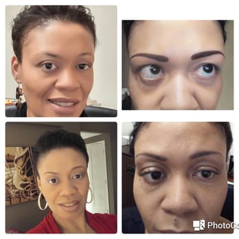 Beauty Techniques - On the left.top natural.bottom left with brow makeup. right top, just after the procedure. bottom right is after healing for 11 days. - Skin Care Near Me - Pasadena, Texas