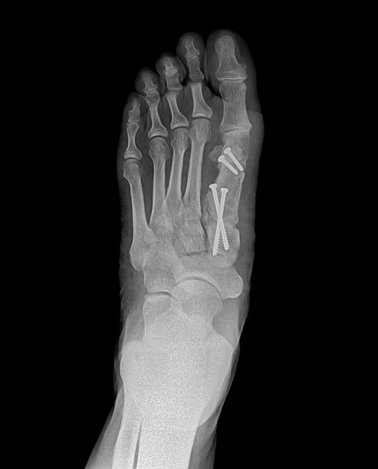 ELITE FOOT & ANKLE SPECIALISTS Updated October 2024 18 Photos