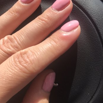 Best Nails Bt&spa - 6 days later, still red and hurts - Nail Salons Near Me - Plantation, Florida
