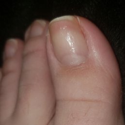 3 days after my pedi with regular clear polish. Extremely poor service in every way. 3 days after my pedi with regular clear polish. Extremely poor service in every way.