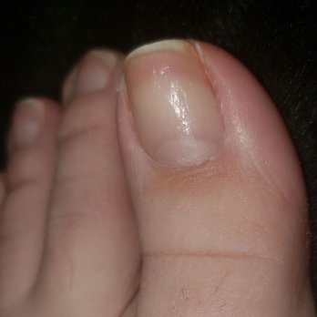 LYLY Nails & Spa - 3 days after my pedi with regular clear polish. Extremely poor service in every way. - Nail Salons Near Me - Milwaukee, Wisconsin LYLY Nails & Spa - 3 days after my pedi with regular clear polish. Extremely poor service in every way. - Nail Salons Near Me - Milwaukee, Wisconsin