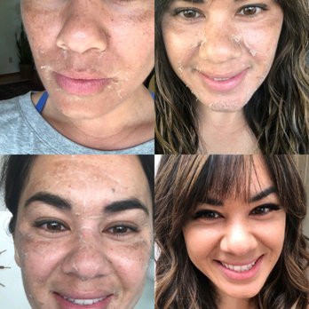 Harley True - Skin Care Near Me - Portland, Oregon
