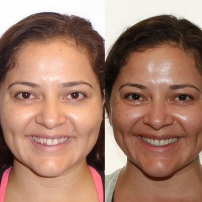 Agoura Orthodontics by Snow by null