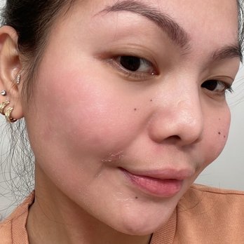 Vglow Beauty Bar - My skin does look and feel more radiant and healthier, thank you VGLOW - Skin Care Near Me - Costa Mesa, California Vglow Beauty Bar - My skin does look and feel more radiant and healthier, thank you VGLOW - Skin Care Near Me - Costa Mesa, California