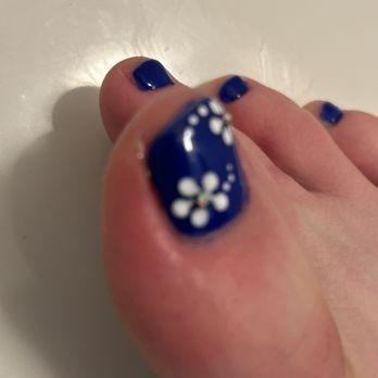 Plush Nail Bar - Infected toe after pedicure - Nail Salons Near Me - Scottsdale, Arizona Plush Nail Bar - Infected toe after pedicure - Nail Salons Near Me - Scottsdale, Arizona