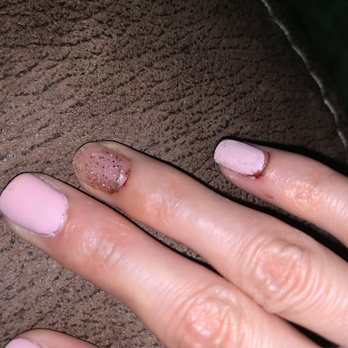 Pretty Nail Lounge - My two fingers that were left bleeding - Nail Salons Near Me - Montebello, California Pretty Nail Lounge - My two fingers that were left bleeding - Nail Salons Near Me - Montebello, California