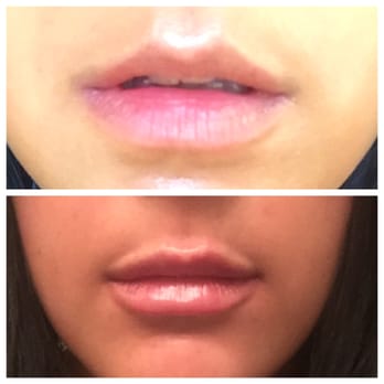 Project Glammers - Before on top, after on the bottom! - Skin Care Near Me - New York, New York Project Glammers - Before on top, after on the bottom! - Skin Care Near Me - New York, New York