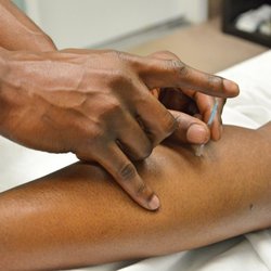 DreamWorx PT - Trigger-point Dry Needling