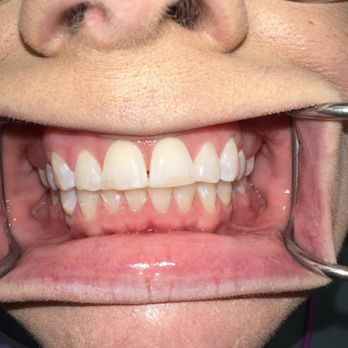 Largo Dental Studio - General Dentistry Near Me - Largo, Florida Largo Dental Studio - General Dentistry Near Me - Largo, Florida