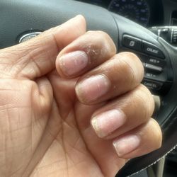 Solar Nail & Spa - Asked for a soak off and manicure , as you can see under nails still dirty ! Dead skin not removed , cuticles still look a mess