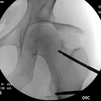 NITROrthopaedics Northern Illinois Trauma Regional Orthopaedics - Orthopedists Near Me - Rockford, Illinois NITROrthopaedics Northern Illinois Trauma Regional Orthopaedics - Orthopedists Near Me - Rockford, Illinois