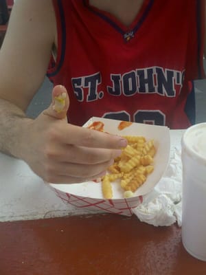 Duk's Red HOTS by null