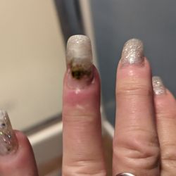 Nail Lab & Spa - HERE'S ONE OF THE TWO INFECTED NAILS I GOT FROM NAIL LAB...8 DAYS AFTER SERVICE