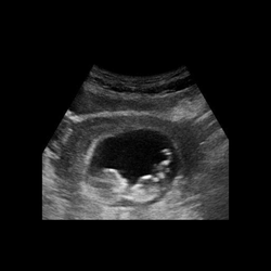 Hope Pregnancy Center