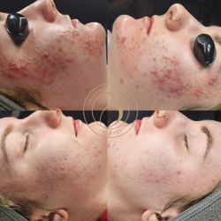 Buffalo Skincare Therapy