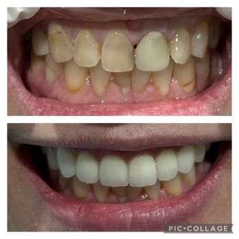 DJ Dental Group - Cosmetic Dentists Near Me - La Palma, California DJ Dental Group - Cosmetic Dentists Near Me - La Palma, California