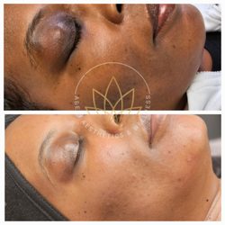 Abeni Aesthetics & Wellness  - The perfect pairing--at-home medical care and in-office treatments working together for visible, lasting results.