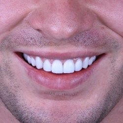 Tavory Family Dentistry: Yaron Tavory, DMD, PA