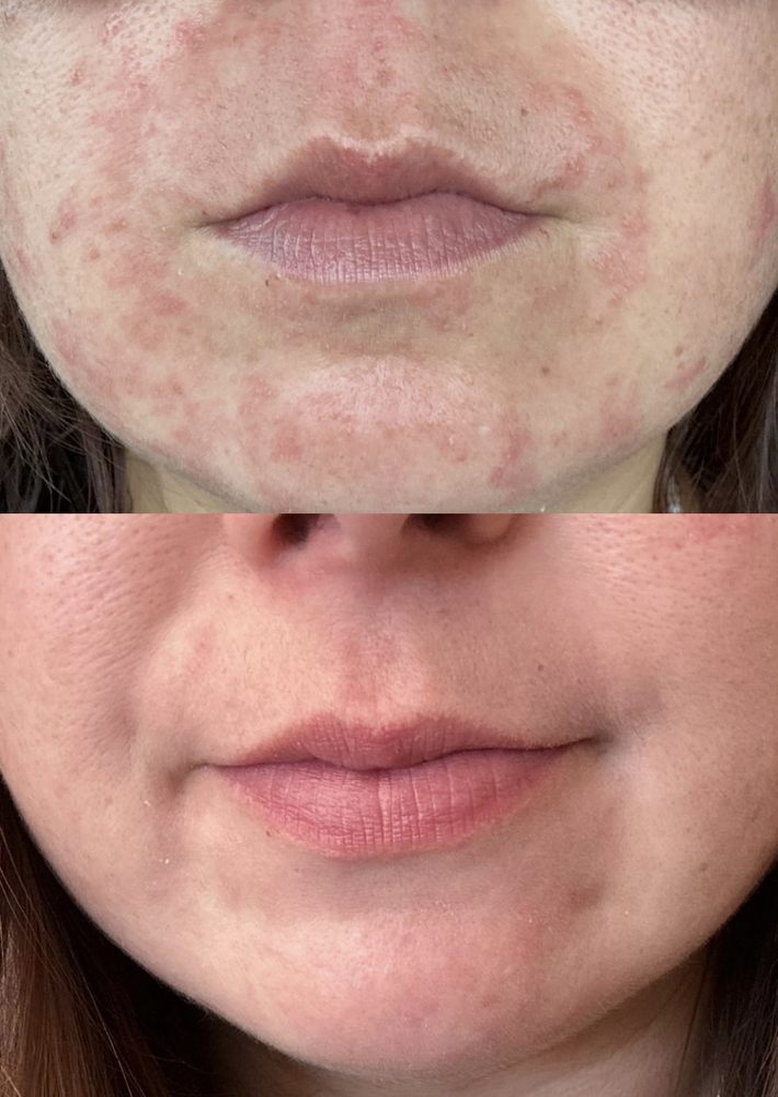 o Jupiter Florida Real Estate For Sale