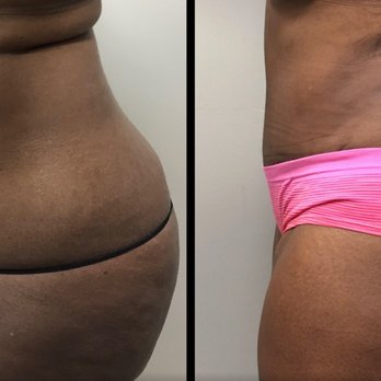 Jude LaBarbera, MD  - Mesa - Plastic Surgeons Near Me - Mesa, Arizona
