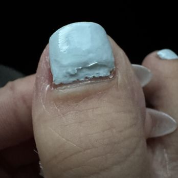 Picasso Nail And Spa - My toes are already ugly and instead of asking if I wanted my crack repaired he just polished over. $50 pedicure - Nail Salons Near Me - Benicia, California